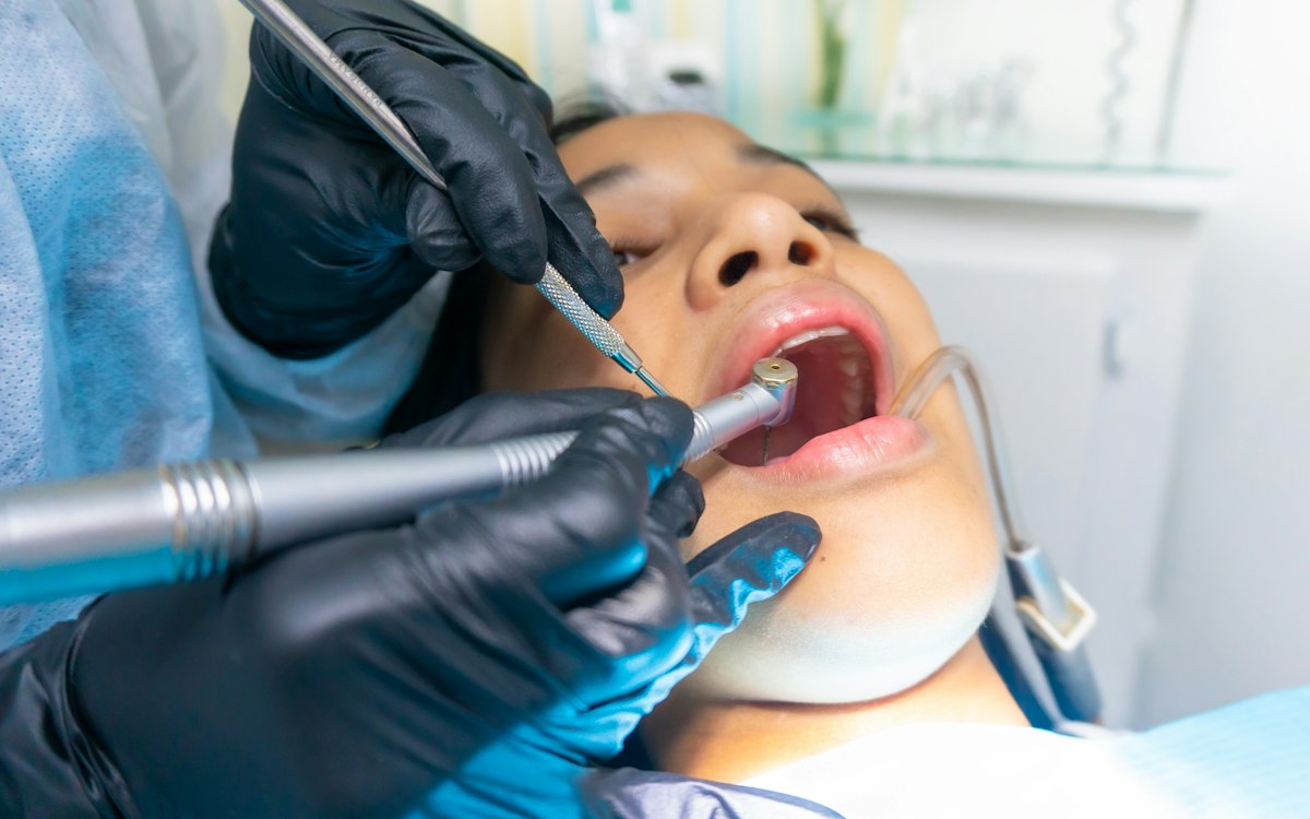 Tratament dentar sub anestezie locală