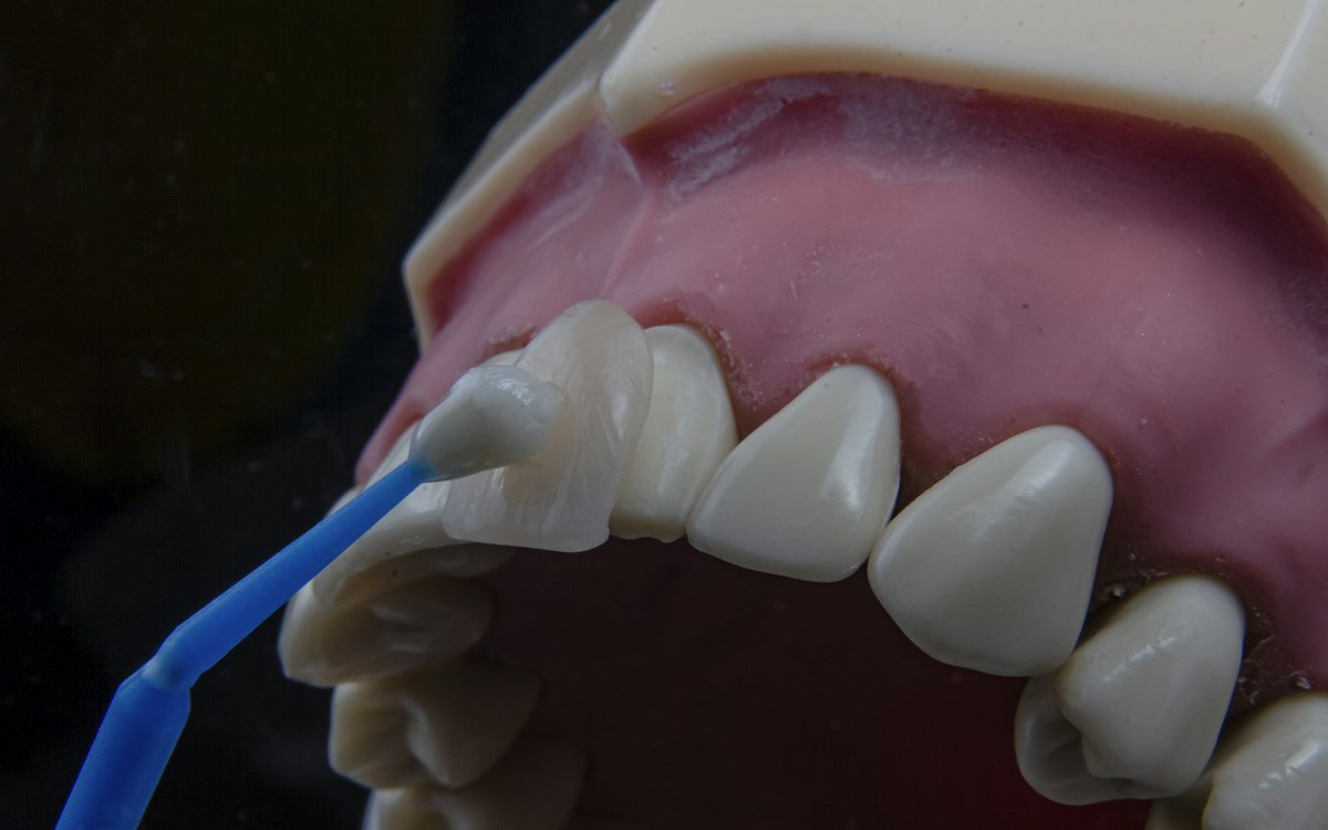 Periuță interdentară folosită pe un model dentar