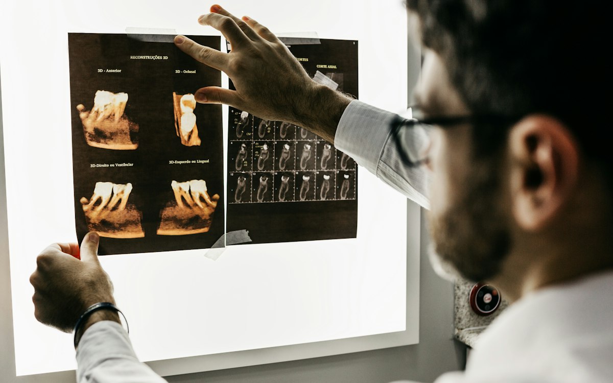 Medic stomatolog analizând radiografii dentare